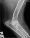 Left elbow extended taken at 24 months